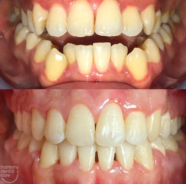 Dokter Gigi Palsu Terbaik Jakarta